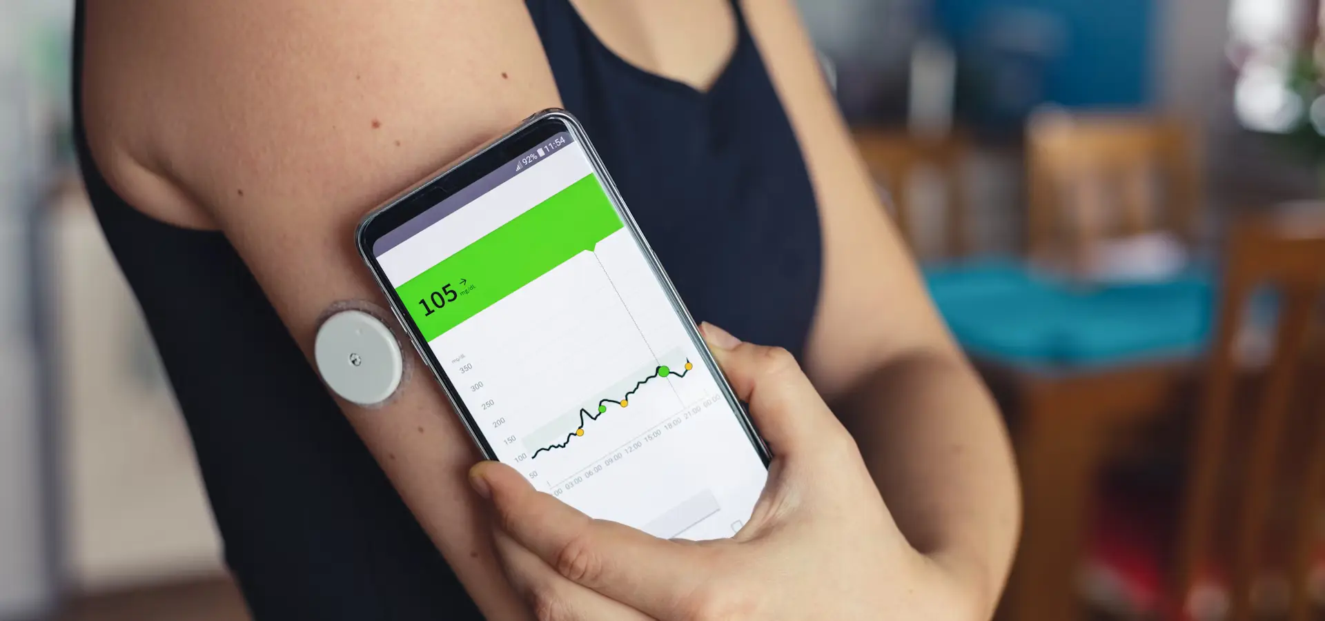 A continuous glucose monitor (CGM) device at work